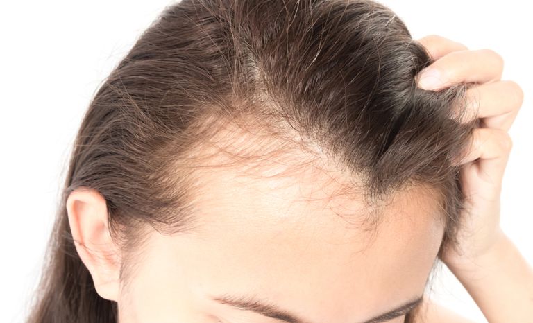 Hair And Scalp Problems