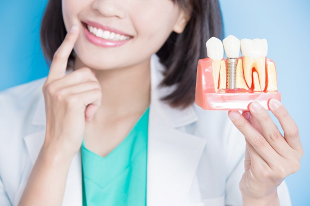 Why Are Dental Implants More Ideal Option for Tooth Loss?