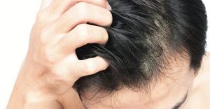 Hair And Scalp Problems